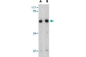 Western blot analysis of HAP1 in mouse brain tissue lysate with HAP1 polyclonal antibody  at (A) 0. (HAP1 antibody  (Internal Region))