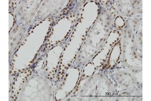 Immunostaining (ISt) image for anti-Decapping Enzyme, Scavenger (DCPS) (AA 1-337) antibody (ABIN526020)