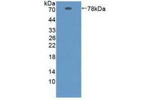 Detection of Recombinant ZPI, Human using Polyclonal Antibody to Serpin A10 (SERPINA10) (SERPINA10 antibody  (AA 24-444))