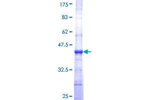 PLVAP Protein (AA 51-150) (GST tag)