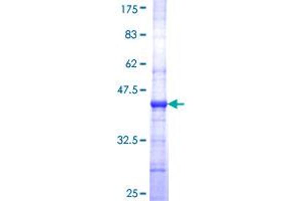 PLVAP Protein (AA 51-150) (GST tag)