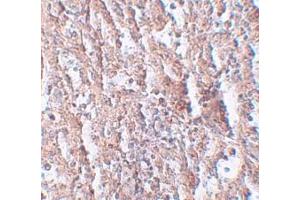 Immunohistochemistry (IHC) image for anti-Solute Carrier Family 39 (Metal Ion Transporter), Member 5 (SLC39A5) (Middle Region) antibody (ABIN1031181) (SLC39A5 antibody  (Middle Region))