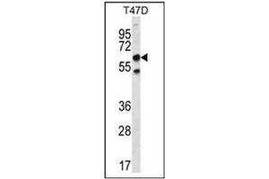 Western blot analysis of SCP2 Antibody (N-term) Cat. (SCP2 antibody  (N-Term))