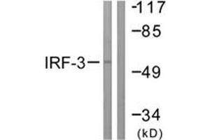 Western blot analysis of extracts from K562 cells, using IRF3 (Ab-385) Antibody. (IRF3 antibody  (AA 351-400))