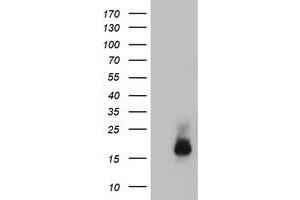 Image no. 1 for anti-Cystatin C (CST3) antibody (ABIN1497754) (CST3 antibody)