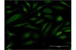 Immunofluorescence of monoclonal antibody to EIF1AY on HeLa cell. (EIF1AY antibody  (AA 31-120))