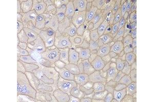 Immunohistochemistry of paraffin-embedded Human esophagus using ANXA1 Polyclonal Antibody at dilution of 1:100 (40x lens). (Annexin a1 antibody)
