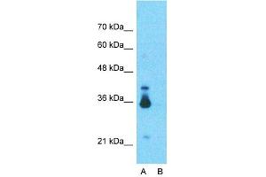 Western Blotting (WB) image for anti-Lactate Dehydrogenase B (LDHB) (C-Term) antibody (ABIN2783283)