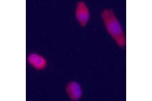 Immunofluorecence staining of GPC3 polyclonal antibody  on HepG2 cells . (Glypican 3 antibody  (Internal Region))