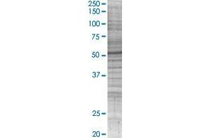 G6PD transfected lysate. (G6PD 293T Cell Transient Overexpression Lysate(Denatured))