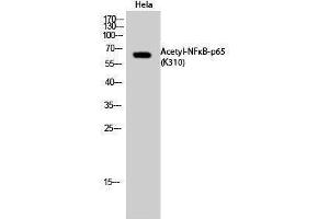 Western Blotting (WB) image for anti-Nuclear Factor-kB p65 (NFkBP65) (acLys310) antibody (ABIN3172824) (NF-kB p65 antibody  (acLys310))