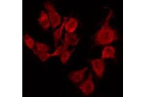 ABIN6267494 staining Hela by IF/ICC. (SREBF1 antibody  (pSer439))