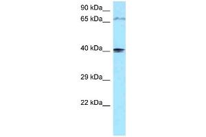 WB Suggested Anti-PIP5KL1 Antibody Titration: 1. (PIP5KL1 antibody  (C-Term))