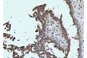 IHC analysis of Glutaminase/GLS using anti-Glutaminase/GLS antibody (ABIN7601601). (Glutaminase antibody  (AA 396-654))