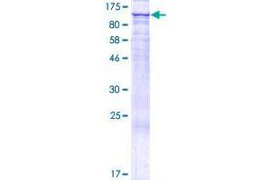 STRIP2 Protein (AA 1-758) (GST tag)