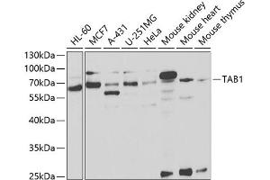 Western blot analysis of extracts of various cell lines, using T antibody (ABIN6131955, ABIN6148795, ABIN6148796 and ABIN6221421) at 1:1000 dilution. (TAB1 antibody  (AA 205-504))