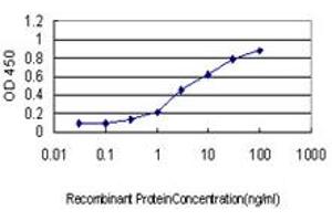 Detection limit for recombinant GST tagged GCK is approximately 0. (GCK antibody  (AA 356-465))