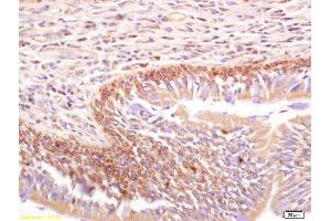 Immunohistochemistry (Paraffin-embedded Sections) (IHC (p)) image for anti-Talin (TLN) (pSer425) antibody (ABIN703135)