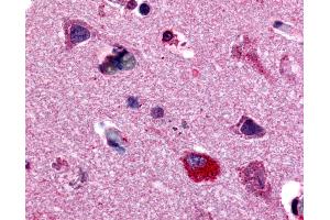 Anti-MAPK3 / ERK1 antibody IHC of human neurons and glia. (ERK1 antibody  (Internal Region))