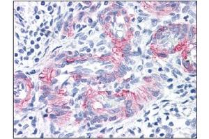 Immunohistochemistry (IHC) image for anti-Melanoma Cell Adhesion Molecule (MCAM) antibody (ABIN614548) (MCAM antibody)