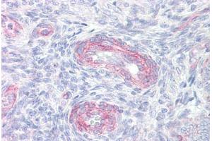Anti-PLA2G4A antibody IHC staining of human uterus, vessels. (PLA2G4A antibody  (AA 471-520))