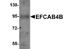 Western Blotting (WB) image for anti-EF-Hand Calcium Binding Domain 4B (EFCAB4B) (C-Term) antibody (ABIN1030378) (EFCAB4B antibody  (C-Term))