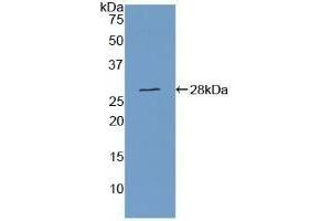Detection of Recombinant CSE, Human using Polyclonal Antibody to Cystathionine (CTH) (Cystathionine (AA 163-382) antibody)