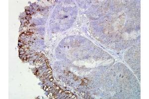 Hsp90 (AC-16), Human Colon Cancer 1 in 2000, Amplifier (HSP90 antibody)