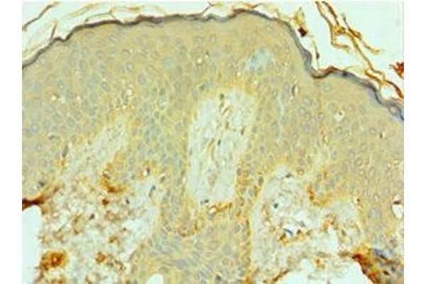FOSL1 antibody  (AA 1-100)