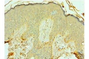 Immunohistochemistry of paraffin-embedded human skin tissue using ABIN7153122 at dilution of 1:100 (FOSL1 antibody  (AA 1-100))