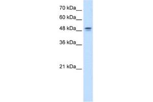 Western Blotting (WB) image for anti-Dihydroorotate Dehydrogenase (DHODH) antibody (ABIN2462489) (DHODH antibody)