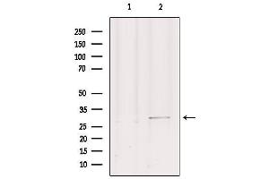 Western blot analysis of extracts from mouse brain, using GEMIN2 Antibody. (SIP1 antibody  (N-Term))