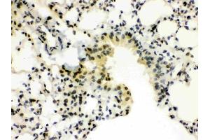 IHC analysis of SP3 using anti-SP3 antibody (ABIN3043350). (Sp3 antibody  (C-Term))