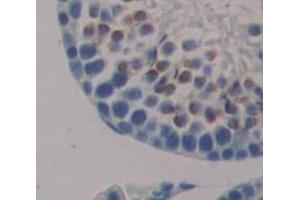 Used in DAB staining on fromalin fixed paraffin- embedded Kidney tissue (Nanog antibody  (AA 1-305))