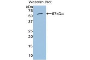 Western Blotting (WB) image for anti-Aldehyde Dehydrogenase 7 Family, Member A1 (ALDH7A1) (AA 28-539) antibody (ABIN1077761) (ALDH7A1 antibody  (AA 28-539))