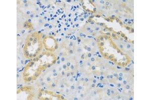Immunohistochemistry of paraffin-embedded Rat kidney using PMPCB Polyclonal Antibody at dilution of 1:100 (40x lens). (PMPCB antibody)