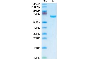 Human Alkaline Phosphatase on Tris-Bis PAGE under reduced condition. (Alkaline Phosphatase Protein (ALP) (AA 23-506) (His tag))