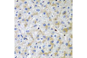 Immunohistochemistry of paraffin-embedded human liver injury using SRGN antibody at dilution of 1:200 (40x lens). (SRGN antibody)