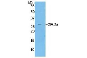 Detection of Recombinant ITGaD, Human using Polyclonal Antibody to Integrin Alpha D (ITGaD) (ITGAD antibody  (AA 879-1099))