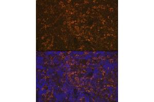 Immunofluorescence analysis of rat spleen using LSP1 Rabbit mAb (ABIN7268319) at dilution of 1:100 (40x lens). (LSP1 antibody)