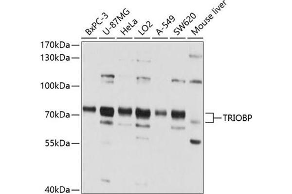 TRIOBP Antikörper  (AA 180-310)