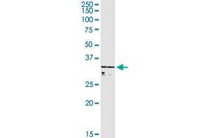 WBSCR22 MaxPab rabbit polyclonal antibody. (WBSCR22 antibody  (AA 1-281))