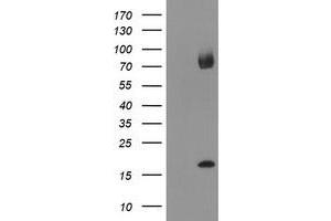 HEK293T cells were transfected with the pCMV6-ENTRY control (Left lane) or pCMV6-ENTRY TPD52L3 (Right lane) cDNA for 48 hrs and lysed. (TPD52L3 antibody)
