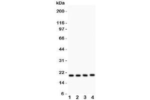 Western blot testing of DJ-1 antibody and human samples 1:  PANC;  2: U20S;  3: SMMC-7721;  4: HeLa lysate.