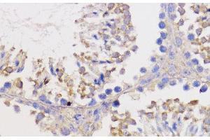 Immunohistochemistry of paraffin-embedded Mouse testis using Bcl-2 Polyclonal Antibody at dilution of 1:100 (40x lens). (Bcl-2 antibody)