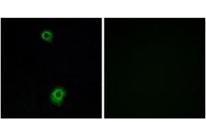 Immunofluorescence analysis of A549 cells, using HTR1B Antibody. (5HT1B Receptor antibody  (AA 261-310))