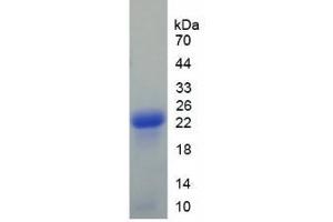 SDS-PAGE of Protein Standard from the Kit  (Highly purified E.
