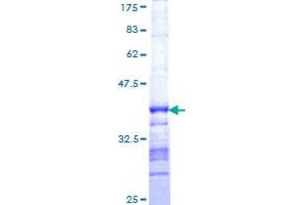 DPYSL3 Protein (AA 457-555) (GST tag)