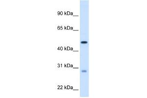 WB Suggested Anti-ECHS1 Antibody Titration:  1. (ECHS1 antibody  (C-Term))