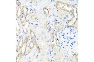 Immunohistochemistry of paraffin-embedded rat kidney using BSND antibody. (BSND antibody  (AA 54-320))